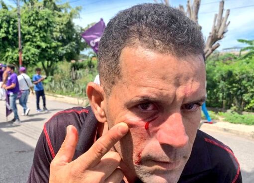 Aragua: Instan a Tarek William Saab investigar agresiones que habrían hecho unos concejales chavistas a unos dirigentes opositores