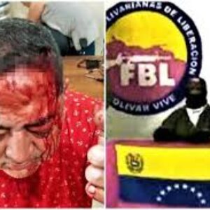 Al doctor Harold Maldonado: El FBL lo golpeó y amenazó a retirar su candidatura a la alcaldía de Arismendi en Barinas