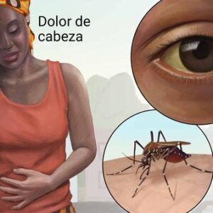 Alertan Roja: Vuelven los brotes de fiebre amarilla en Venezuela