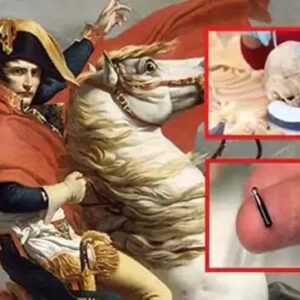 La ‘teoría’ del chip en el cráneo de Napoleón tras ser abducido por extraterrestres