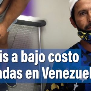 Hecho en socialismo bolivariano «mesmo»: Vea las prótesis populares de los discapacitados de bajos recursos