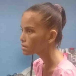 Impactante (imágenes fuertes) Joven madre sobrevive con herida abierta en abdomen desde hace cuatro meses en hospital Noriega Trigo del Zulia