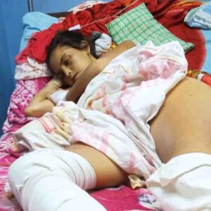 Tomado de Elvigilanteweb.com: “Mi hija se muere y nadie hace algo por ella” Padres de la joven con una herida abierta en el abdomen claman por ayuda