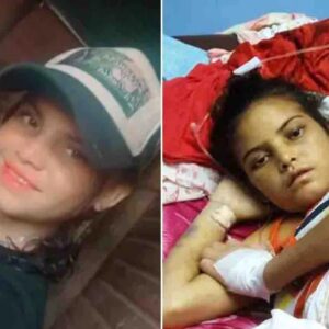 Consternación en Zulia: Fallece Rosa Paz, la joven que sobrevivió cuatro meses con una herida abierta en el abdomen