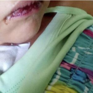 Trujillo de luto: Tras dos meses de agonía muere niña envenenada por su madrastra