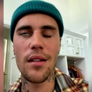 Tendencia: ¿Qué es el síndrome de Ramsay Hunt? La condición que causó una parálisis facial a Justin Bieber