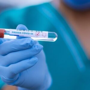 Venezuela: Reportan 196 contagios de coronavirus