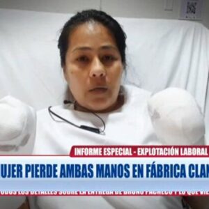 Otra tragedia a los que emigran: Mujer pierde sus dos manos en Perú Ver Vídeo
