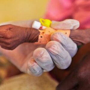 GRAVE: Más de la mitad de los niños en Venezuela están mal alimentados
