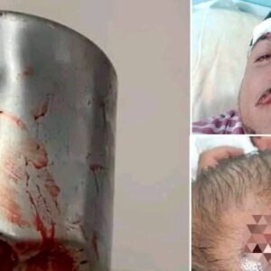 ¡Se salvó por un pelito! Mujer ataca a su esposo con una olla de presión tras descubrir una presunta infidelidad