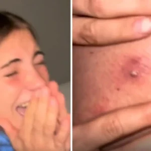 #VIRAL: Una joven le explotó un punto negro a su papá y todo terminó muy mal