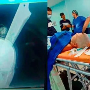 #INSÓLITO Durante una pelea de mujeres: Le clavaron un cuchillo en la cabeza y sobrevivió
