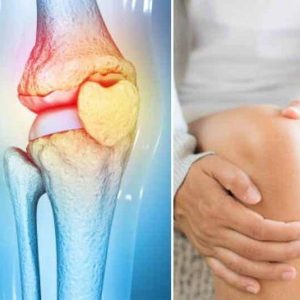 La importancia del ejercicio para prevenir y tratar la osteoporosis de manera efectiva