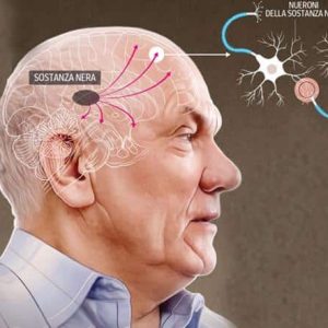 Parkinson: qué dicen las nuevas guías de ejercicios físicos recomendados