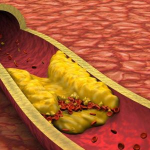 Cómo bajar el colesterol de forma rápida y natural, según un nutricionista deportivo: «Es clave consumir…»