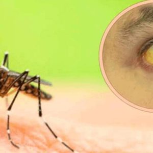 ¡HAY UN BROTE PREOCUPANTE DE FIEBRE AMARILLA! ¿Cómo identificar los primeros signos de alerta? || Instan a vacunarse