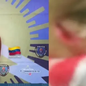 Desfigura el rostro a su sobrina de 16 años por un plato de arroz