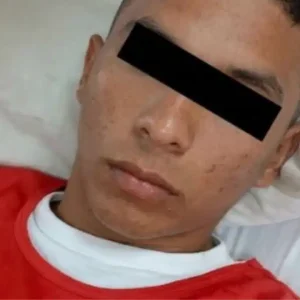Tragedia laboral en Mauroa: Obrero murió asfixiado dentro de un pozo artesanal